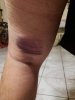 hamstring 1-6-19.jpg